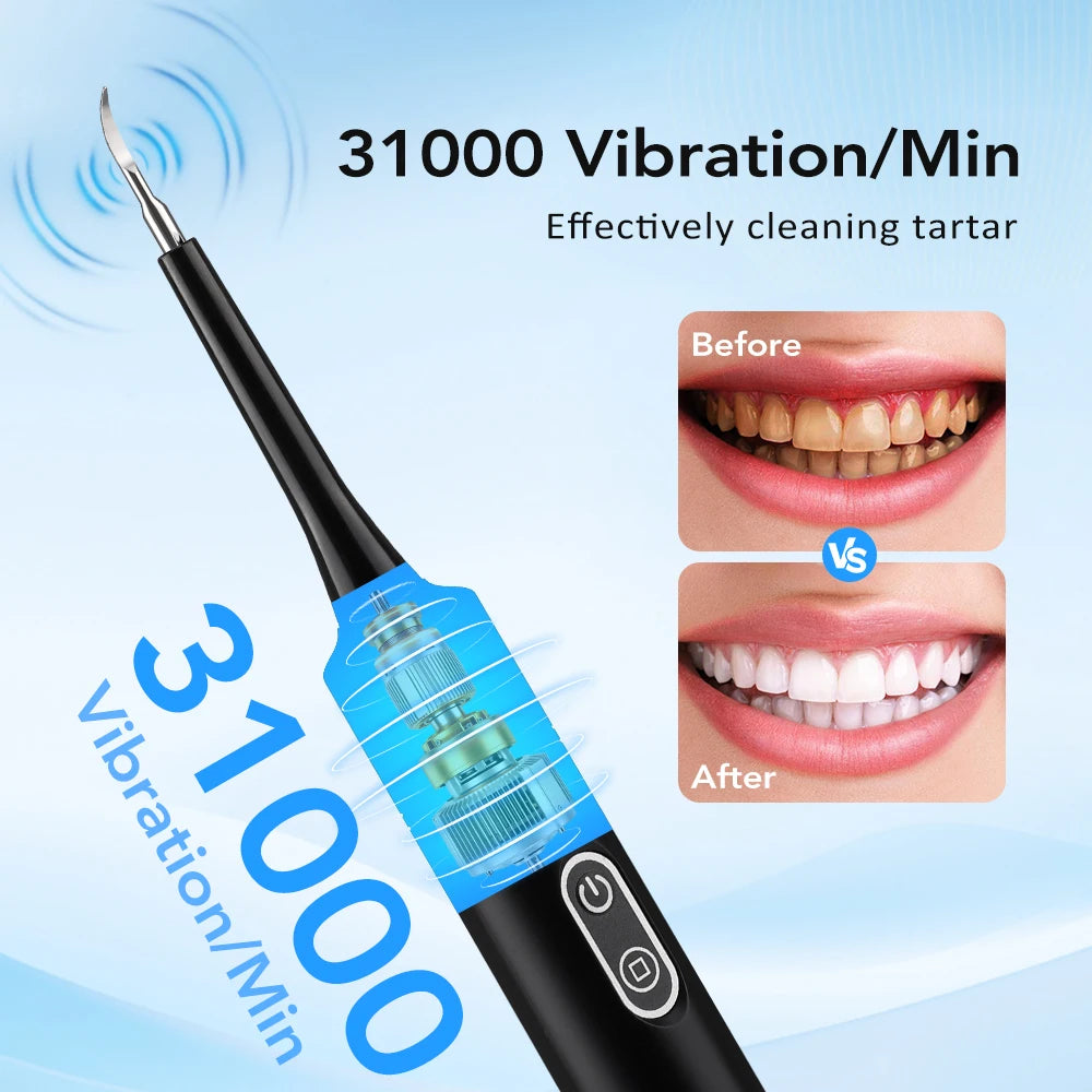 Electric Dental Scaler with Teeth Brush Head Calculus Tartar Remover